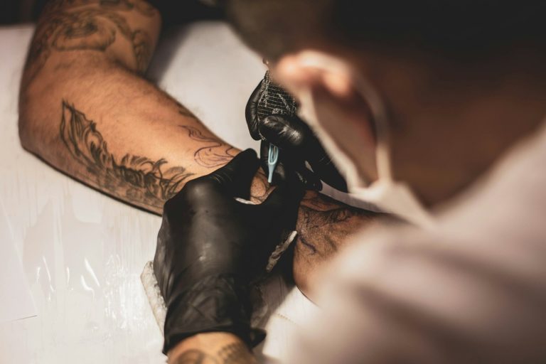 How to Prepare for Your Tattoo Removal Session: Essential Tips